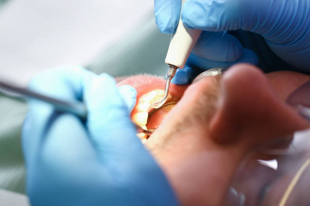 Best Pediatric Emergency Dentist in Atlantic, IA